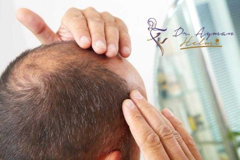 افضل عيادة زراعة شعر